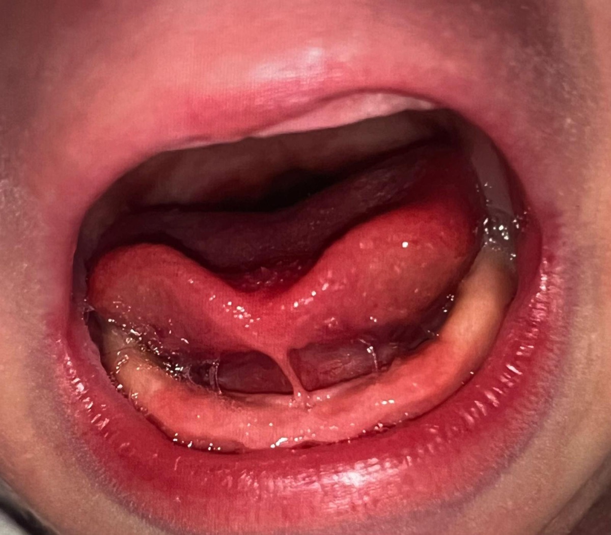 Before division: close-up of the underside of an infant’s tongue